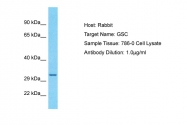 ARP32174_P050 - Homeobox protein goosecoid / GSC