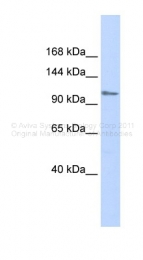 ARP32193_P050 - ZFPM1 / FOG1