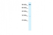 ARP32243_T100 - Ah receptor / AhR