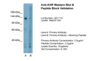 ARP32243_T100 - Ah receptor / AhR