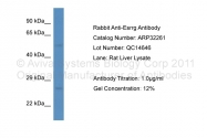 ARP32261_P050 - Estrogen-related receptor gamma