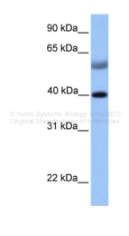 ARP32336_P050 - Islet-1 / ISL1