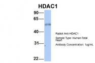 ARP32358_P050 - HDAC1
