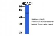 ARP32358_P050 - HDAC1