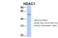 ARP32358_P050 - HDAC1