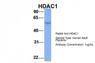 ARP32358_P050 - HDAC1