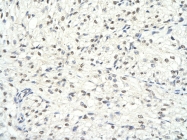 ARP32358_P050 - HDAC1