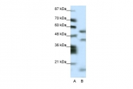 ARP32374_P050 - LHX1