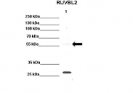 ARP32379_P050 - RUVBL2 / TIP49B