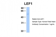 ARP32404_P050 - LEF1