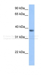 ARP32417_P050 - NEUROD6