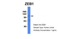 ARP32422_P050 - ZEB1