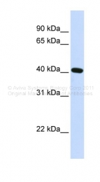 ARP32432_P050 - PITX2