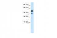 ARP32468_P050 - CTBP1