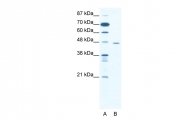 ARP32468_T100 - CTBP1