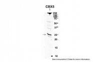ARP32481_T100 - CBX5