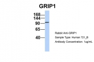 ARP32497_P050 - GRIP1