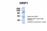 ARP32497_P050 - GRIP1