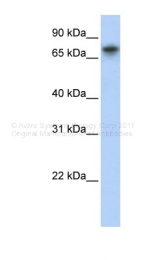 ARP32521_P050 - TRIM29 / ATDC