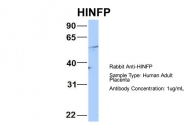 ARP32543_P050 - MIZF