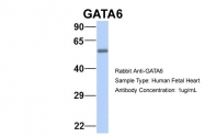 ARP32550_P050 - GATA6