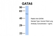 ARP32550_P050 - GATA6