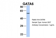 ARP32550_P050 - GATA6