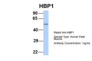 ARP32559_P050 - HBP1