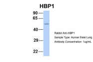 ARP32559_P050 - HBP1