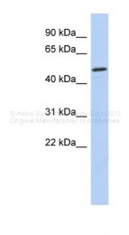ARP32588_P050 - CHK1