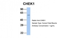 ARP32588_P050 - CHK1