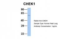 ARP32588_P050 - CHK1