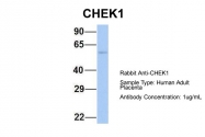 ARP32588_P050 - CHK1