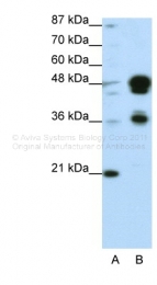 ARP32630_P050 - FOXA1 / TCF3A