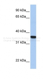 ARP32644_P050 - HOXD1 / HOX4G