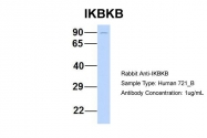 ARP32665_P050 - IKBKB / IKKB