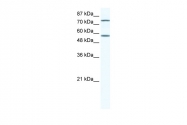 ARP32669_T100 - IRF4
