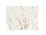 ARP32752_P050 - OLIG2