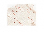 ARP32753_P050 - OLIG2