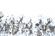 ARP32799_T100 - Adiponectin