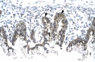 ARP32807_P050 - Prohibitin / PHB