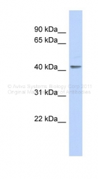 ARP32809_P050 - Krueppel-like factor 1 (KLF1)