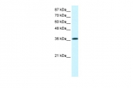 ARP32810_T100 - Krueppel-like factor 1 (KLF1)