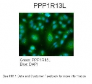 ARP32826_P050 - PPP1R13L