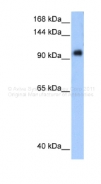 ARP32826_P050 - PPP1R13L