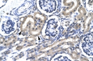 ARP32828_P050 - TRAFD1 / FLN29