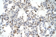 ARP32867_P050 - DLX5