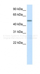 ARP32899_P050 - Tristetraproline (TTP)
