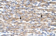 ARP32920_P050 - BARX1