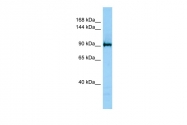 ARP32974_P050 - JMJD2C / KDM4C